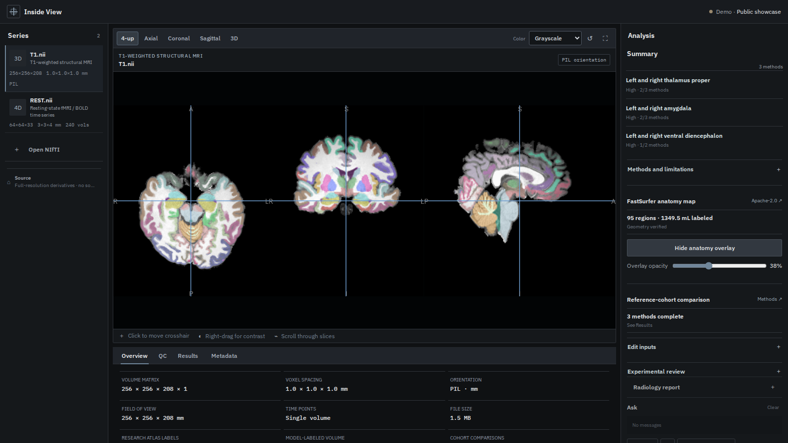 Brain MRI Viewer
